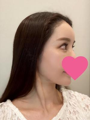 椿 こずえの写メ日記｜ローテンブルク 吉原高級店ソープ